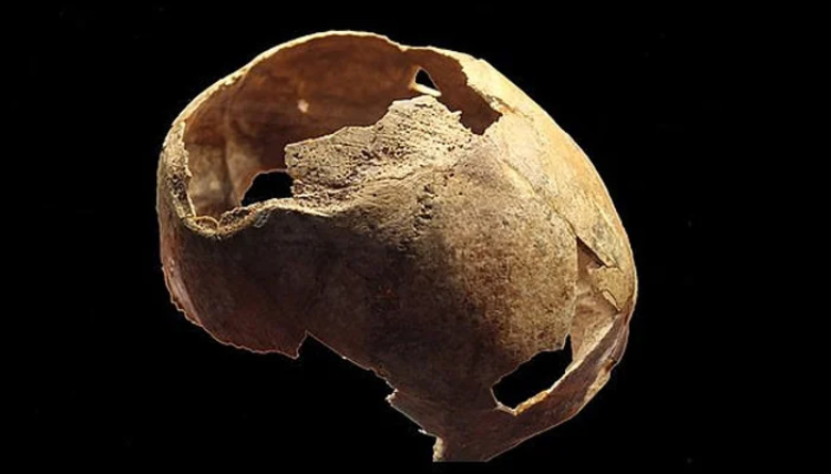5 ہزار سال قدیم آپریشن ہوئی کھوپڑی دریافت