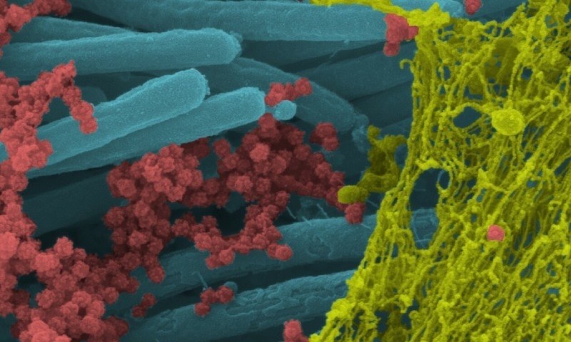 کورونا وائرس کس طرح خلیات کو متاثر کرتا ہے؟ چونکا دینے والی تصاویر