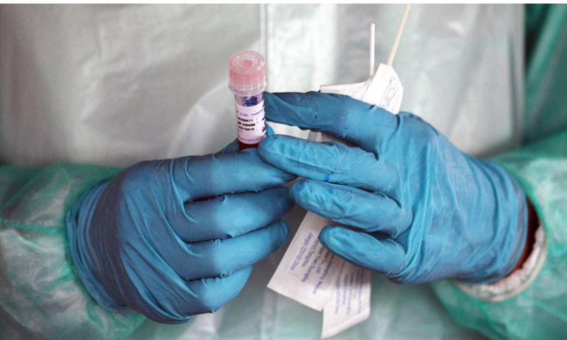 لعاب دہن ٹیسٹ کورونا وائرس کی تشخیص کا مؤثر ذریعہ قرار