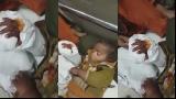 پاکستانی ڈاکٹرز کا بڑا کارنامہ، بچے کا کٹا ہاتھ جوڑ دیا