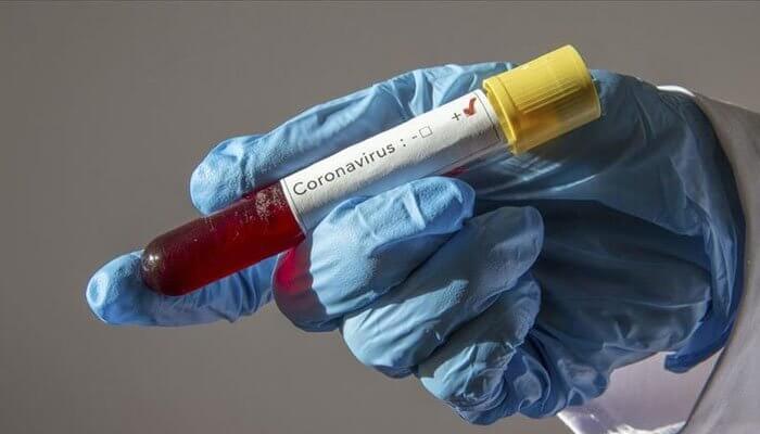 برطانیہ میں سامنے آنے والا نیا کورونا وائرس پاکستان پہنچ گیا
